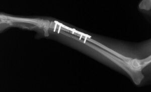 術直後-Lトリミング後