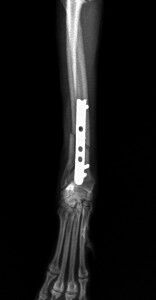 術直後-DVトリミング後