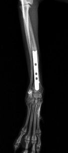 術後3ヶ月-DVトリミング後