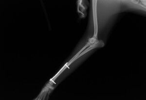 術後4ヶ月-Lトリミング後