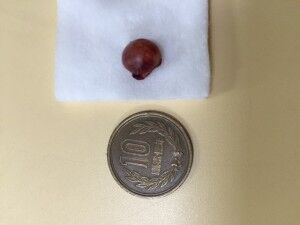 大腿骨頭